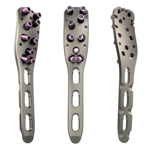 Proximal Humerus Plate